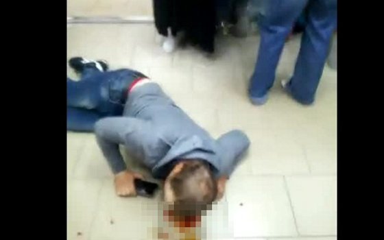 В Вязьме у торгового центра мужчине пробили голову