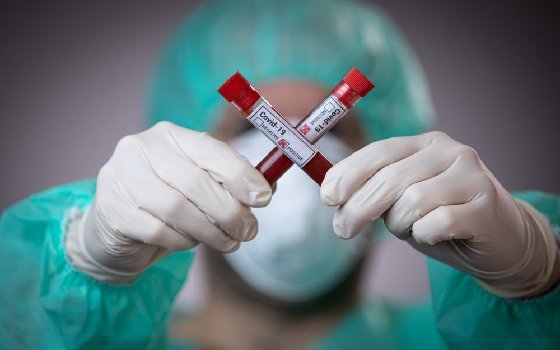 В Смоленской области выявлено 36 новых случаев заражения коронавирусом 