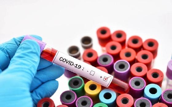 В Вяземском районе выявили 34 новых случая заболевания коронавирусной инфекцией 
