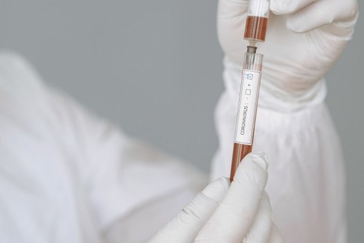 Более 40 тысяч тестов на коронавирус провели на коронавирус в Смоленской области 